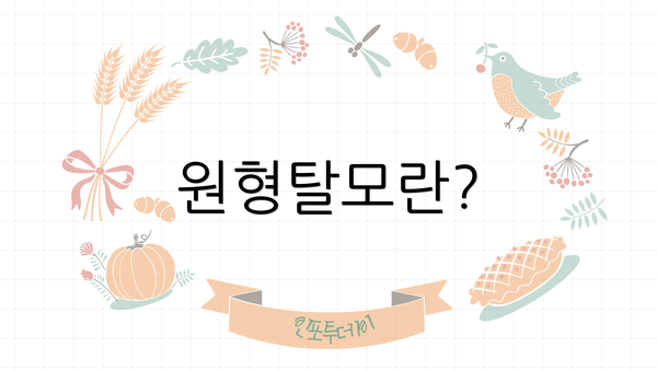 원형탈모란?